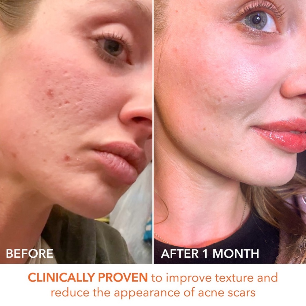 3 for $30-Dr Dennis Gross Alpha Beta Extra Strength Daily Peel Pads - Picture 7 of 16